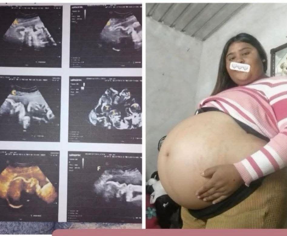 Llama Fiscalía a denunciar a mujer que pedía ayuda por quintillizos