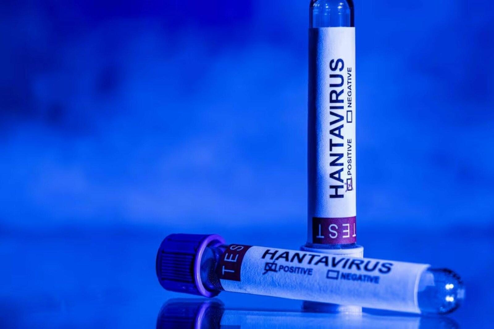 Declarará OMS fin de brote de hantavirus la próxima semana