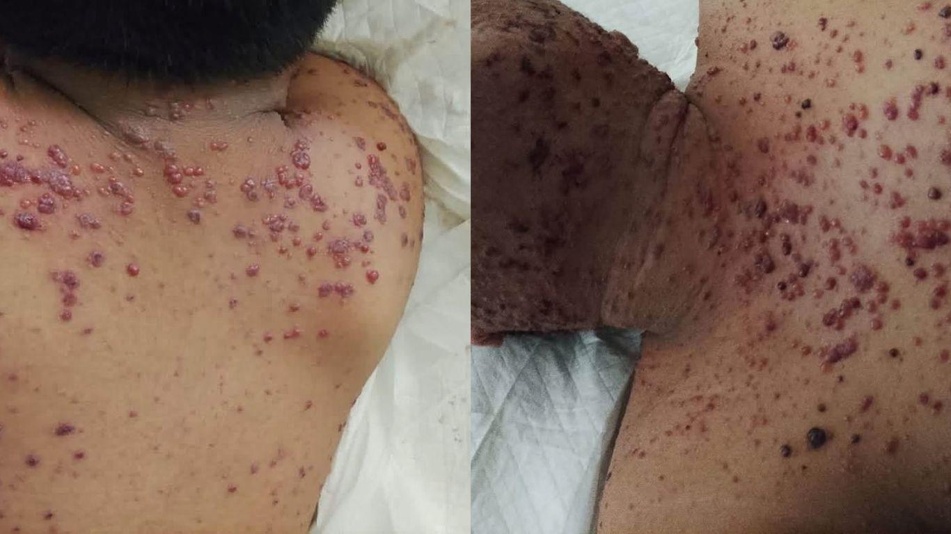Muere adolescente en IMSS de Veracruz; familia denuncia omisiones